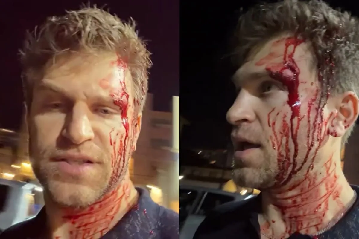 Keegan Allen, de Pretty Little Liars, fue asaltado a punta de pistola en Los Ángeles