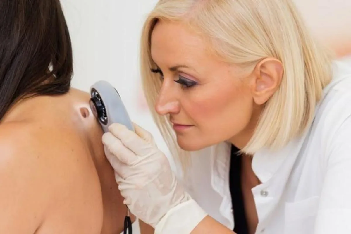 Melanoma: una vacuna de ARNm logró reducir el riesgo de recurrencia y propagación en un ensayo clínico de gran escala