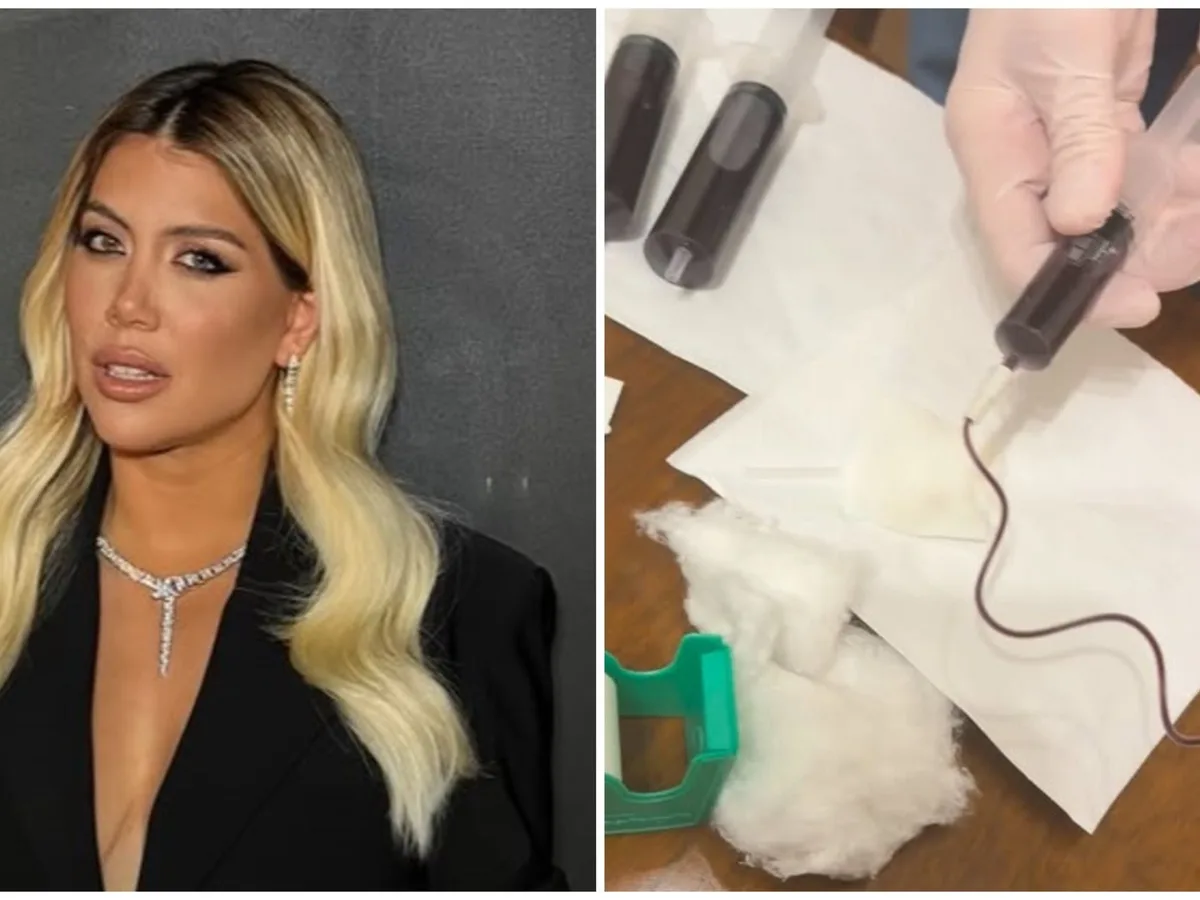 Wanda Nara mostró la intimidad de sus controles médicos por la leucemia: “Hoy arranqué así”