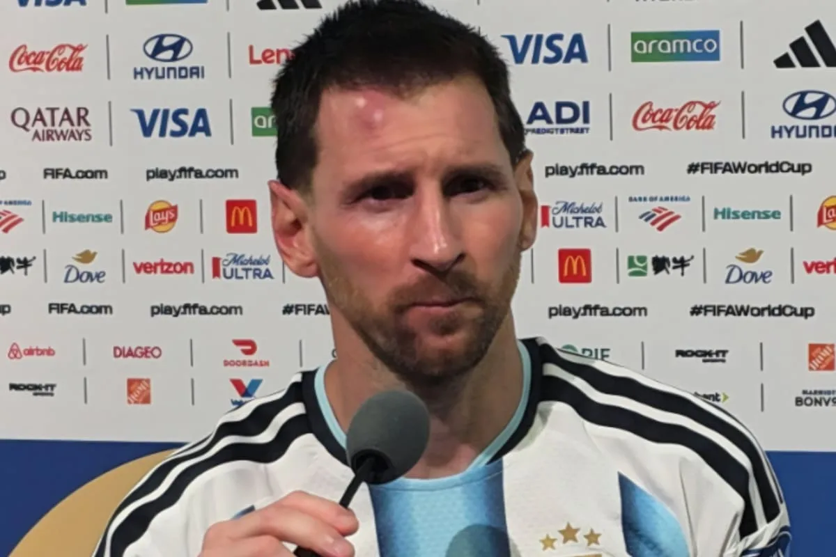 El golpe de Messi en la frente: así quedó tras el choque ante Cabo Verde