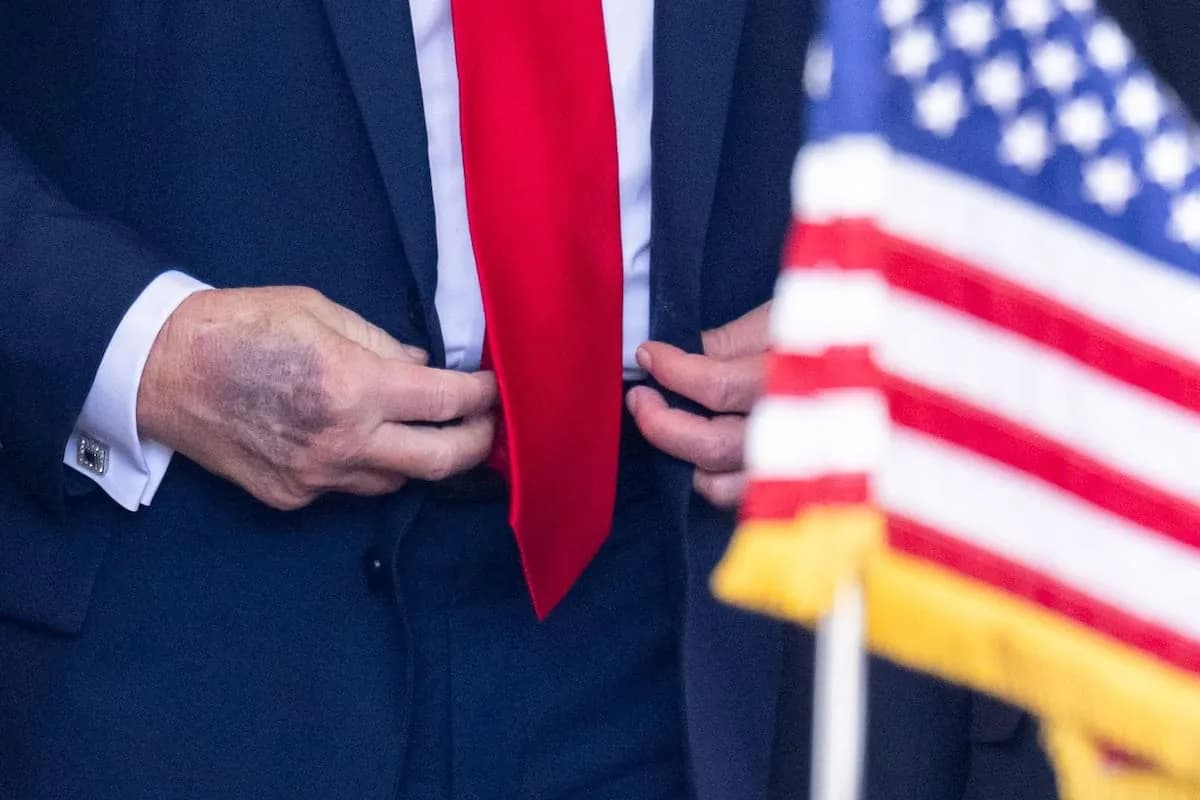 Trump se somete a chequeo médico a los 79 años mientras crece el escrutinio sobre su salud