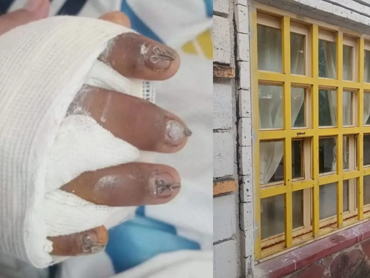 Un alumno perdió el 95% de su mano al caer una ventana en una escuela de Jujuy