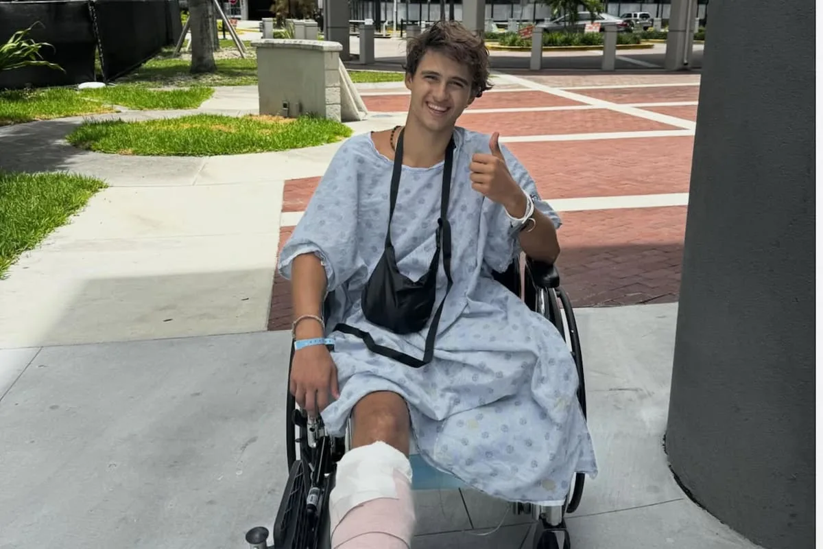 Survivor Grecia: participante compartió su primera foto tras amputación de pierna